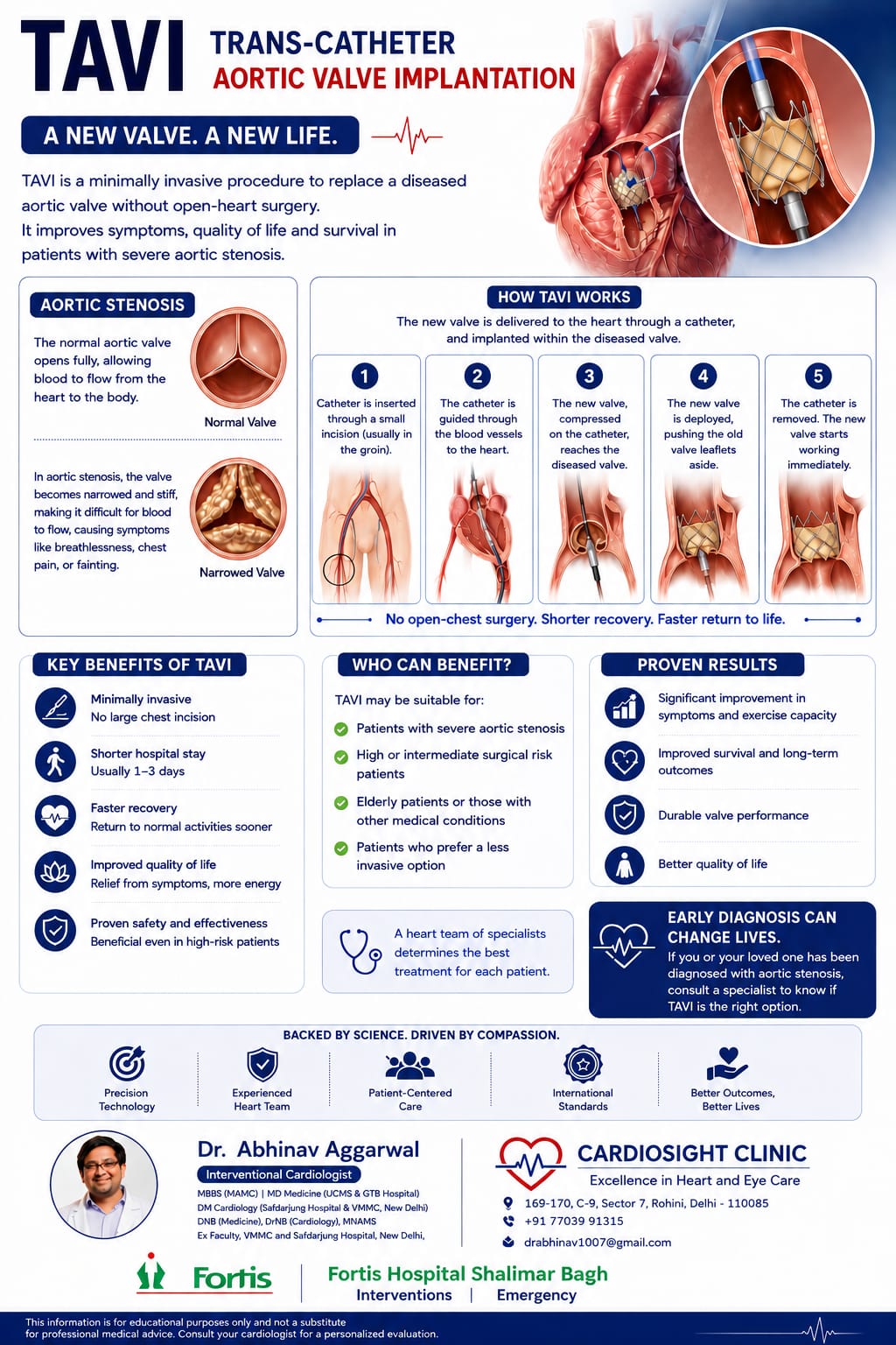 Infographic explaining TAVI: normal versus narrowed aortic valve in aortic stenosis, the five steps of how the new valve is delivered by catheter and implanted, key benefits, who can benefit, and proven results.